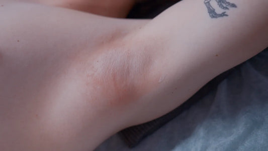 Derma testing: Why a patch test matters (and how to do it right)