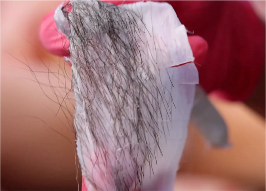 White Bumps After Brazilian Wax: Your Expert Guide to Causes & Solutions